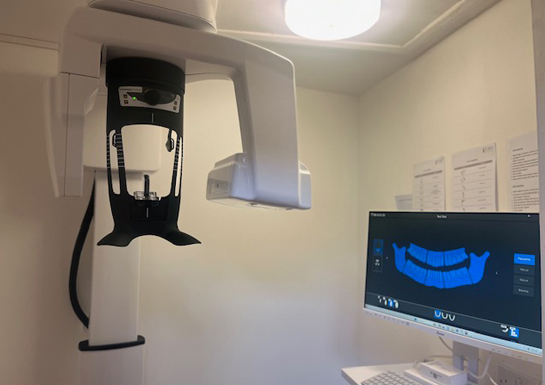 CBCT/OPG