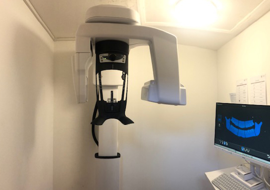 CBCT/OPG